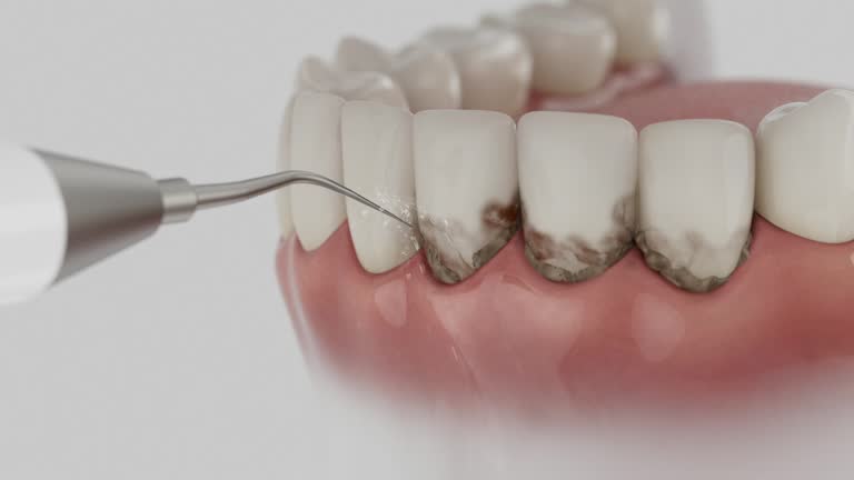 Reliable Dental Implants contractor in Laporte, CO by Smile Center Dentistry